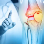 Lifestyle Changes That Can Improve Your Knee Care