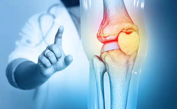 Lifestyle Changes That Can Improve Your Knee Care