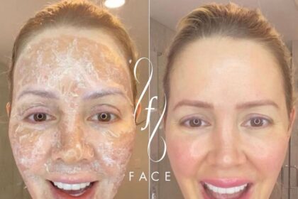 3 Treatments for Skin Rejuvenation