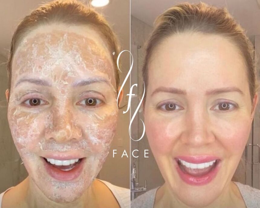3 Treatments for Skin Rejuvenation