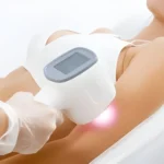 Benefits of Professional Laser Hair Removal vs. At-home Remedies