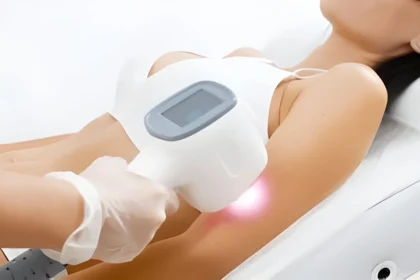 Benefits of Professional Laser Hair Removal vs. At-home Remedies