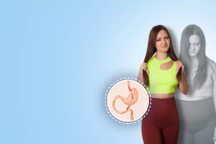 Exploring the Benefits and Risks of Bariatric Surgery