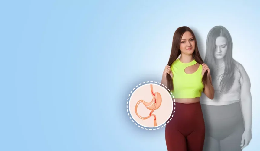 Exploring the Benefits and Risks of Bariatric Surgery