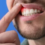Exploring the Link Between Hormones and Skin Conditions