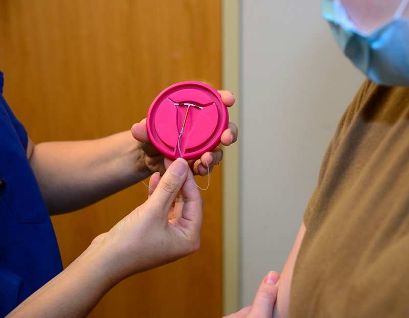 FAQs About Vasectomies and Sexual Health