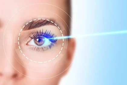 Frequently Asked Questions About Lasik