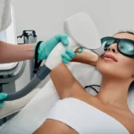 How To Prepare for Your Laser Hair Removal Appointment