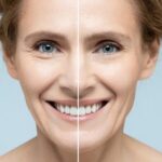 How to Choose the Right Dermatologist for Your Skin Concerns