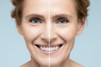 How to Choose the Right Dermatologist for Your Skin Concerns