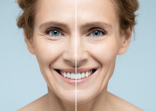 How to Choose the Right Dermatologist for Your Skin Concerns