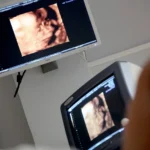 Knowing When To See a Gynecologist