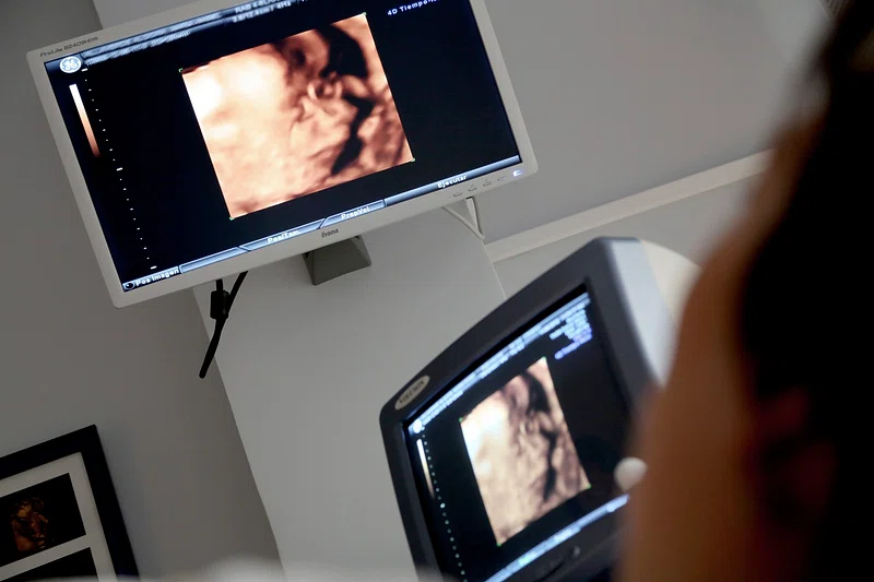 Knowing When To See a Gynecologist