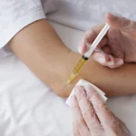 PRP Injections and What To Expect