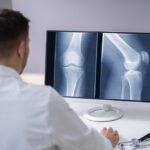 Questions To Ask an Orthopedic Surgeon at Your Appointment