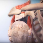 Symptoms and Causes of Rotator Cuff Tears