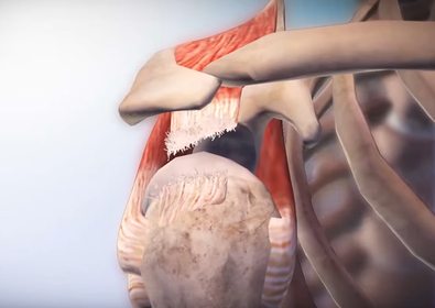 Symptoms and Causes of Rotator Cuff Tears