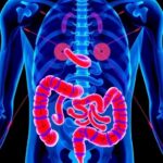 The Role of Genetics in Colon Cancer Screening