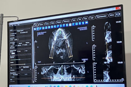 The Role of Technology in Modern Endodontics