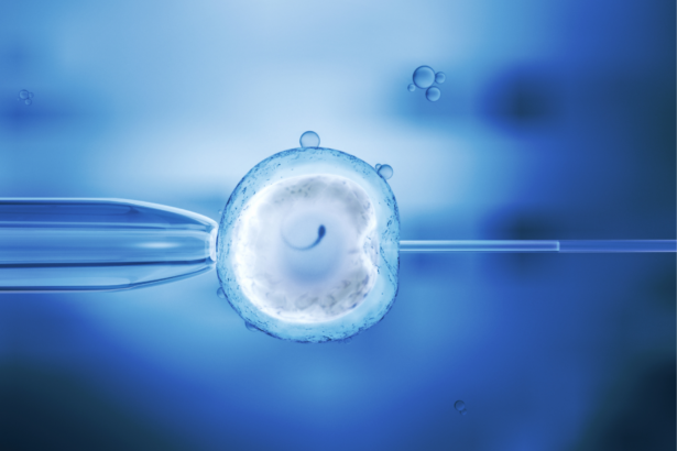 Tips for Preparing for the IVF Process