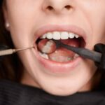 Tips for Preventing Cavities and Gum Disease