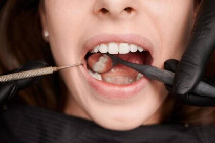 Tips for Preventing Cavities and Gum Disease