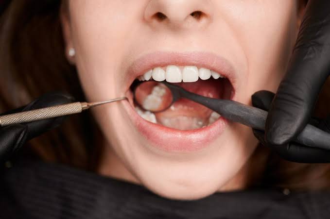 Tips for Preventing Cavities and Gum Disease