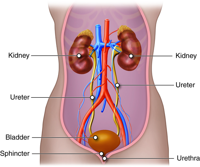 Understanding Causes and Prevention of Kidney Stones