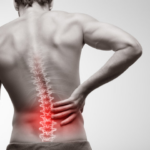 Understanding Degenerative Disc Disease