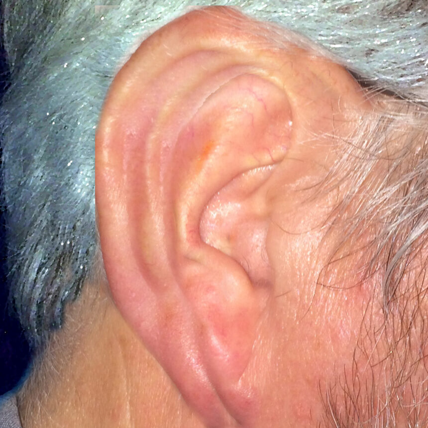 Understanding Ear Infection Symptoms in Adults
