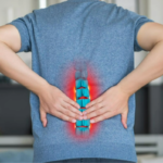 Understanding the Indications for Disc Replacement Surgery