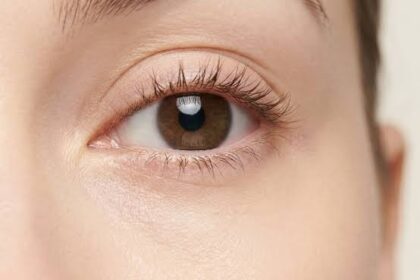 What To Know About Laser Vision Correction Options