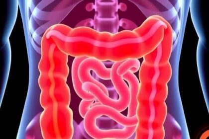 Why a Colonoscopy Is Key for Colorectal Cancer Screening