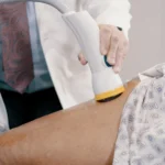 An Introduction to Shockwave Therapy and Its Applications in Pain Relief