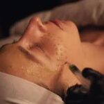 Exploring Treatments for Rosacea