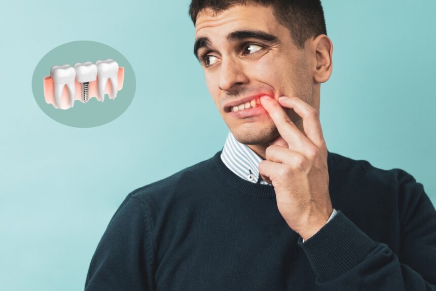 Factors To Review When Choosing Dental Implants for Your Smile