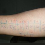 How Does Allergy Testing Work?