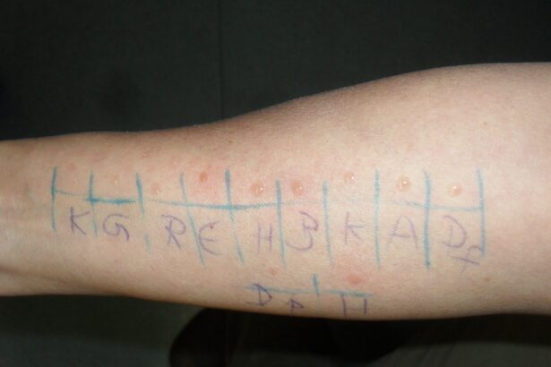 How Does Allergy Testing Work?