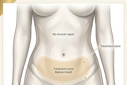 Long-term Benefits of a Tummy Tuck
