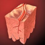 Recognizing Symptoms of Chest Pain