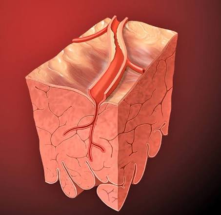 Recognizing Symptoms of Chest Pain