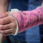 Signs You Need to See a Hand Doctor for Your Pain