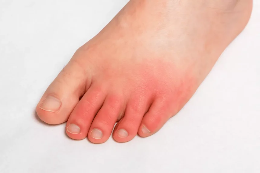 Understanding Treatment and Recovery Options for Deep Vein Thrombosis