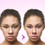 What Does a Plastic Surgeon Do