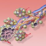 What Is Bronchitis and How Is It Treated?