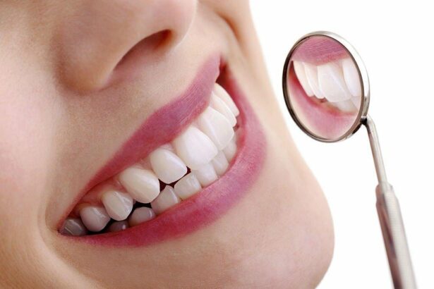What to Expect from Tooth Sensitivity After Veneer Treatments