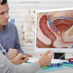 Who Should Get Screened for Prostate Cancer and When