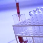 Why Should I Get Tested for Allergies?